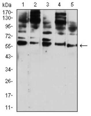 Western Blot: DC-SIGN/CD209 Antibody (5C2A6) [NBP2-61741] - Analysis using CD209 mouse mAb against Hela (1), U937 (2), THP-1 (3), HL-60 (4), and A431 (5) cell lysate.