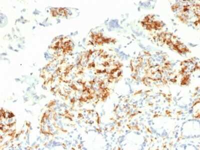 Immunohistochemistry-Paraffin: DC-SIGN/CD209 Antibody (C209/1781) - Azide and BSA Free [NBP2-54351] - Formalin-fixed, paraffin-embedded human Small Intestine stained with CD209 Monoclonal Antibody (C209/1781).