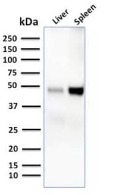 Western Blot: DC-SIGN/CD209 Antibody (C209/1781) - Azide and BSA Free [NBP2-54351] - Western Blot Analysis of human liver and spleen tissue lysates using DC-SIGN/CD209 Antibody (C209/1781).