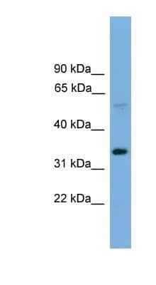 Western Blot: DC-STAMP/TM7SF4 Antibody [NBP1-79329] - Titration: 0.2-1 ug/ml, Positive Control: OVCAR-3 cell lysate.