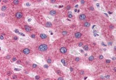 Immunohistochemistry-Paraffin: DC2 Antibody [NBP3-14296] - Immunohistochemistry of formalin-fixed, paraffin-embedded human liver after heat-induced antigen retrieval.