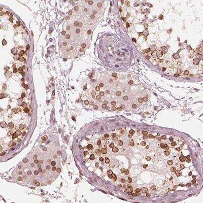 Immunohistochemistry: DCAF12 Antibody [NBP2-56552] - Immunohistochemical staining of human testis shows moderate to strong nuclear membranous positivity in cells in seminiferous ducts and Leydig cells.