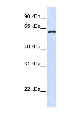 Western Blot: DCAF12 Antibody [NBP1-56584] - 293T cells lysate, concentration 0.2-1 ug/ml.