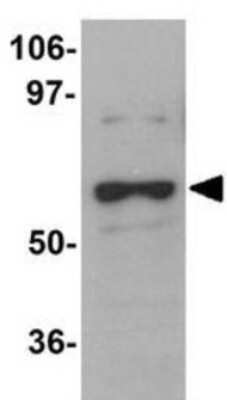 Western Blot DCAF12 Antibody - BSA Free