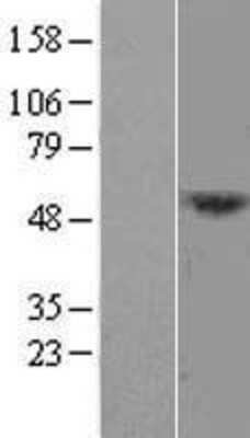 Western Blot: DCAF12L1 Overexpression Lysate (Adult Normal) [NBL1-17806] Left-Empty vector transfected control cell lysate (HEK293 cell lysate); Right -Over-expression Lysate for DCAF12L1.
