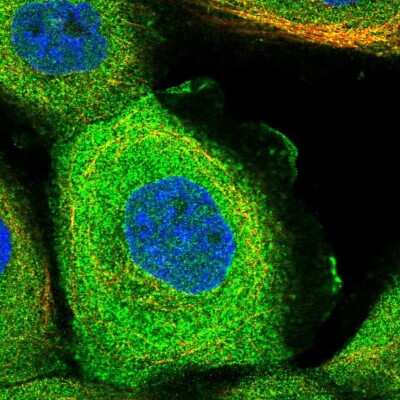 Immunocytochemistry/Immunofluorescence: DCAF16 Antibody [NBP1-91166] - Staining of human cell line A-431 shows localization to plasma membrane & cytosol. Antibody staining is shown in green.