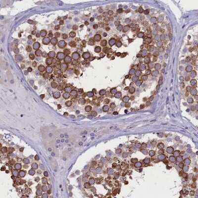 Immunohistochemistry-Paraffin: DCAF16 Antibody [NBP1-91166] - Staining of human testis shows strong  cytoplasmic positivity in cells in seminiferous ducts.