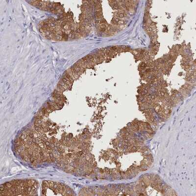 Immunohistochemistry-Paraffin: DCAF16 Antibody [NBP1-91166] - Staining of human prostate shows moderate cytoplasmic positivity in glandular cells.