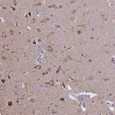 Immunohistochemistry-Paraffin: DCAF16 Antibody [NBP1-91166] - Staining of human cerebral cortex shows moderate cytoplasmic positivity in neurons.