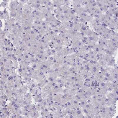 Immunohistochemistry-Paraffin: DCAF16 Antibody [NBP1-91166] - Staining of human liver shows no positivity in hepatocytes as expected.