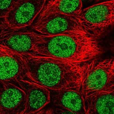 Immunocytochemistry/Immunofluorescence: DCAF4 Antibody [NBP1-91820] - Immunofluorescent staining of human cell line MCF7 shows localization to nucleoplasm.