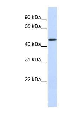 Western Blot: DCAF4 Antibody [NBP1-52862] - Human Muscle lysate, concentration 0.2-1 ug/ml.