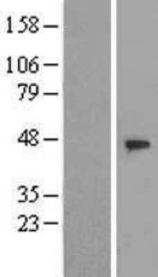 Western Blot: DCAF4 Overexpression Lysate (Adult Normal) [NBL1-17796] Left-Empty vector transfected control cell lysate (HEK293 cell lysate); Right -Over-expression Lysate for DCAF4.
