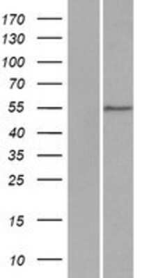 Western Blot: DCAF4 Overexpression Lysate (Adult Normal) [NBP2-07144] Left-Empty vector transfected control cell lysate (HEK293 cell lysate); Right -Over-expression Lysate for DCAF4.