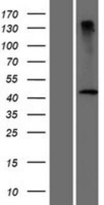 Western Blot: DCAF4L2 Overexpression Lysate (Adult Normal) [NBP2-05371] Left-Empty vector transfected control cell lysate (HEK293 cell lysate); Right -Over-expression Lysate for DCAF4L2.