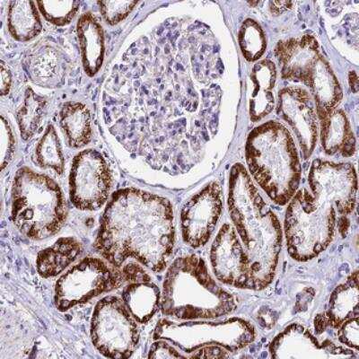 Immunohistochemistry-Paraffin: DCAF5 Antibody [NBP2-30998] - Staining of human kidney shows strong cytoplasmic positivity, with a granular pattern in cells in tubules.