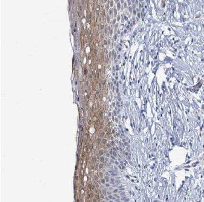 Immunohistochemistry-Paraffin: DCAF5 Antibody [NBP2-30396] - Staining of human cervix, uterine shows moderate cytoplasmic positivity in squamous epithelial cells.