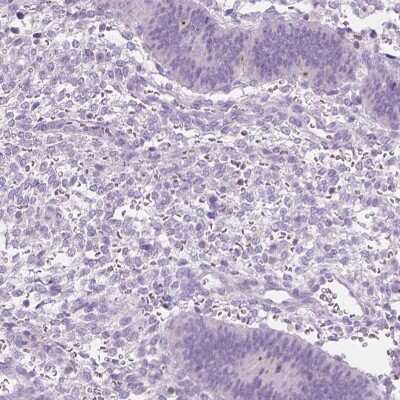 Immunohistochemistry-Paraffin: DCAF8L1 Antibody [NBP1-93435] - Staining of human endometrium shows low expression as expected.