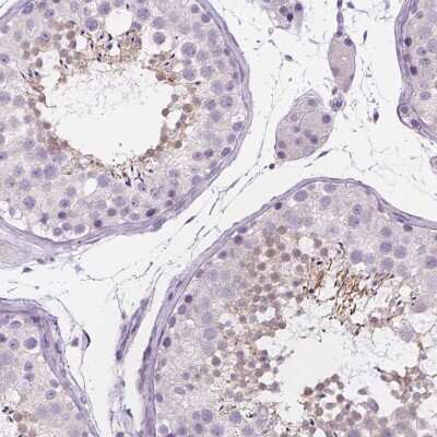 Immunohistochemistry-Paraffin: DCAF8L1 Antibody [NBP1-93435] - Staining of human testis shows high expression.