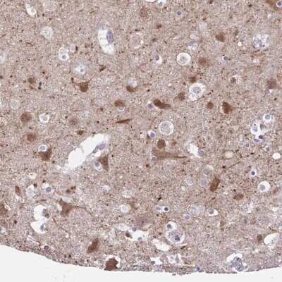 <b>Orthogonal Strategies Validation. </b>Immunohistochemistry-Paraffin: DCAMKL2 Antibody [NBP1-85282] - Staining of human cerebral cortex shows high expression.