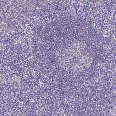 Immunohistochemistry-Paraffin: DCAMKL2 Antibody [NBP1-85282] - Staining of human tonsil shows low expression as expected.