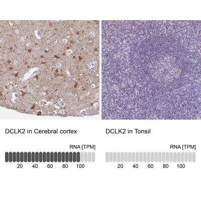 Immunohistochemistry-Paraffin: DCAMKL2 Antibody [NBP1-85282] - Staining in human cerebral cortex and tonsil tissues using anti-DCLK2 antibody. Corresponding DCLK2 RNA-seq data are presented for the same tissues.