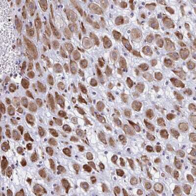 Immunohistochemistry-Paraffin: DCBLD1 Antibody [NBP2-32487] - Staining of human placenta shows strong cytoplasmic positivity in decidual cells.
