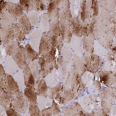 Immunohistochemistry-Paraffin: DCBLD1 Antibody [NBP2-32487] - Staining of human skeletal muscle shows strong cytoplasmic positivity in myocytes.