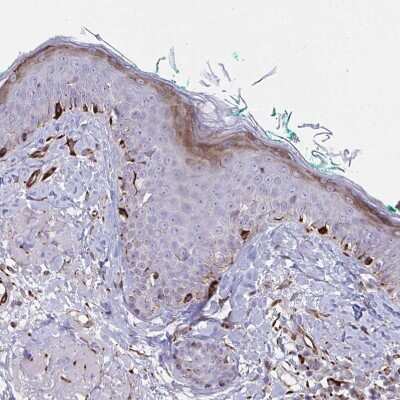 Immunohistochemistry-Paraffin: DCBLD1 Antibody [NBP2-32487] - Staining of human skin shows moderate cytoplasmic positivity in squamous epithelial cells.