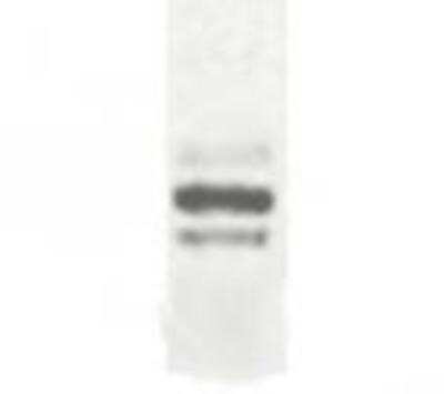 Western Blot: DCBLD2 Antibody [NB100-93567] - Detection of transfected full-length DCBLD2 in 293T cells with anti DCBLD2 at a 1:1000 dilution multiple bands of 93,105 and 127 kDa likely due to post translational modifications.