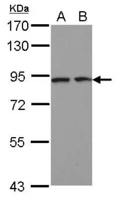 Western Blot DCBLD2/ESDN Antibody