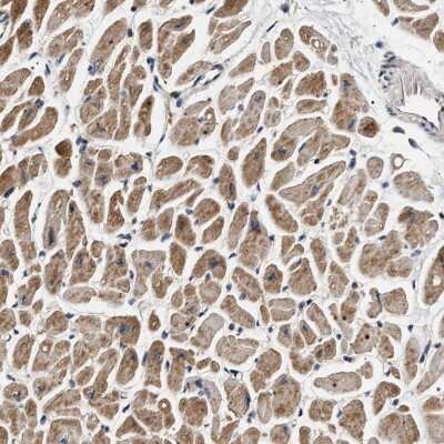 Immunohistochemistry-Paraffin: DCBLD2/ESDN Antibody [NBP1-85582] - Staining of human heart muscle shows moderate cytoplasmic positivity.