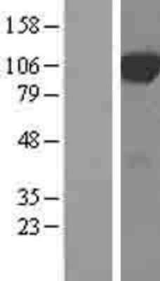 Western Blot: DCBLD2 Overexpression Lysate (Adult Normal) [NBL1-09737] Left-Empty vector transfected control cell lysate (HEK293 cell lysate); Right -Over-expression Lysate for DCBLD2.
