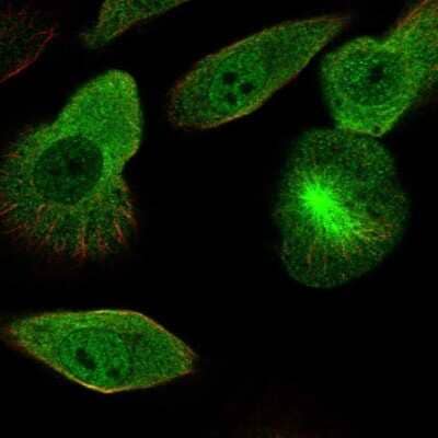 <b>Orthogonal Strategies Validation. </b>Immunocytochemistry/Immunofluorescence: DCDC2 Antibody [NBP2-38184] - Staining of human cell line RPTEC TERT1 shows localization to nucleoplasm, cytosol, microtubule organizing center & mitotic spindle. Antibody staining is shown in green.