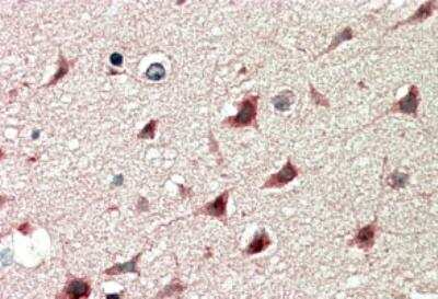 Immunohistochemistry-Paraffin: DCDC2 Antibody [NB100-2806] - Human Cerebral Cortex shows cytoplasm staining in select neurons.