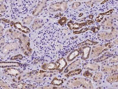 Immunohistochemistry-Paraffin: DCDC2 Antibody [NBP2-97244] - Immunochemical staining of human DCDC2 in human kidney with rabbit polyclonal antibody at 1:500 dilution, formalin-fixed paraffin embedded sections.