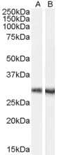 Western Blot: DCDC2 Antibody [NB100-53803] - Staining of mouse brain lysate (35ug protein in RIPA buffer) with A) (0.1ug/ml) and B) EB07059. Primary incubation was 1 hour. Detected by chemiluminescence.