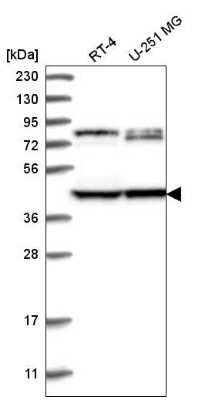 Western Blot: DCDC2 Antibody [NBP2-55048] - Western blot analysis in human cell line RT-4 and human cell line U-251 MG.