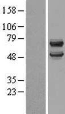 Western Blot: DCDC2 Overexpression Lysate (Adult Normal) [NBL1-09739] Left-Empty vector transfected control cell lysate (HEK293 cell lysate); Right -Over-expression Lysate for DCDC2.