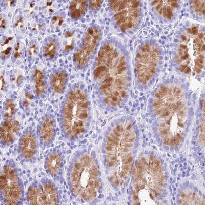 Immunohistochemistry-Paraffin: DCDC2B Antibody [NBP1-94179] Staining of human stomach, upper shows strong cytoplasmic positivity in glandular cells.