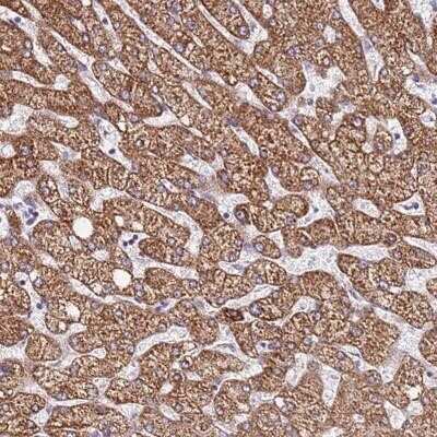Immunohistochemistry-Paraffin: DCDC2C Antibody [NBP1-94180] - Staining of human liver shows strong cytoplasmic positivity in hepatocytes.