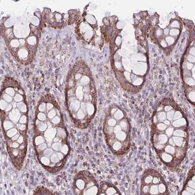 Immunohistochemistry-Paraffin DCHS1 Antibody