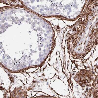 Immunohistochemistry-Paraffin: DCHS2 Antibody [NBP2-38046] - Staining of human testis shows strong cytoplasmic and membranous positivity in Leydig cells.