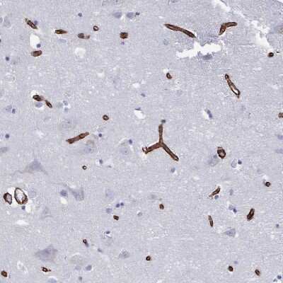Immunohistochemistry-Paraffin: DCHS2 Antibody [NBP2-38046] - Staining of human cerebral cortex shows strong cytoplasmic positivity in endothelial cells.