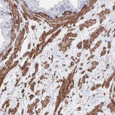 Immunohistochemistry-Paraffin: DCHS2 Antibody [NBP2-38046] - Staining of human prostate shows strong membranous positivity in smooth muscle cells.