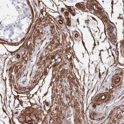 Immunohistochemistry-Paraffin: DCHS2 Antibody [NBP2-38046] - Staining of human testis shows strong membranous positivity in Leydig cells.