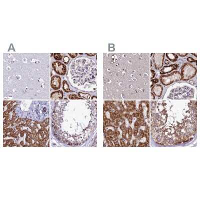 Immunohistochemistry-Paraffin: DCI Antibody [NBP1-91821] - Staining of human cerebral cortex, kidney, liver and testis using Anti-ECI1 antibody NBP1-91821 (A) shows similar protein distribution across tissues to independent antibody NBP1-91822 (B).