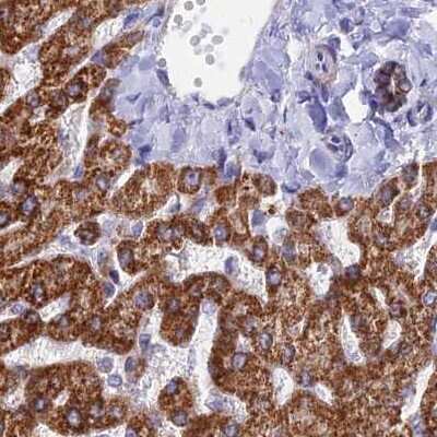 Immunohistochemistry-Paraffin: DCI Antibody [NBP1-91821] - Staining of human liver.