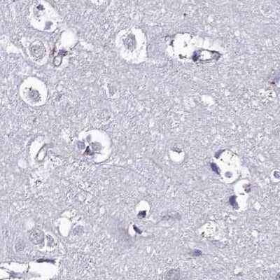 Immunohistochemistry-Paraffin: DCI Antibody [NBP1-91821] - Staining of human cerebral cortex.