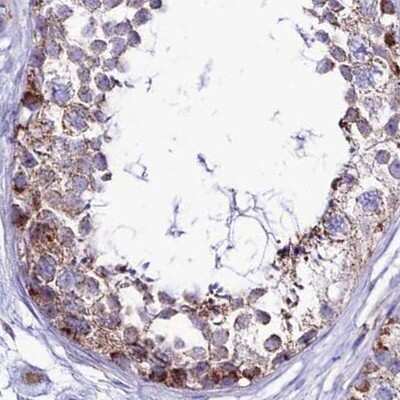 Immunohistochemistry-Paraffin: DCI Antibody [NBP1-91821] - Staining of human testis.